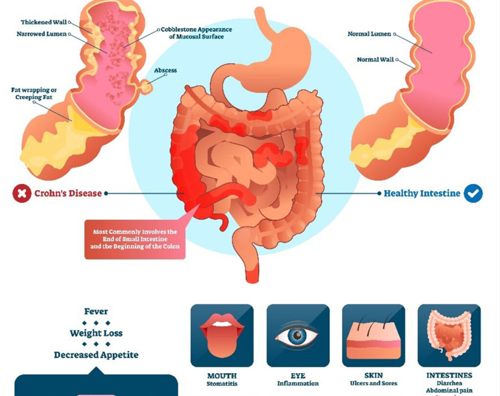 Dr Neeraj Singh - Colon & Rectal Care Center of Phoenix