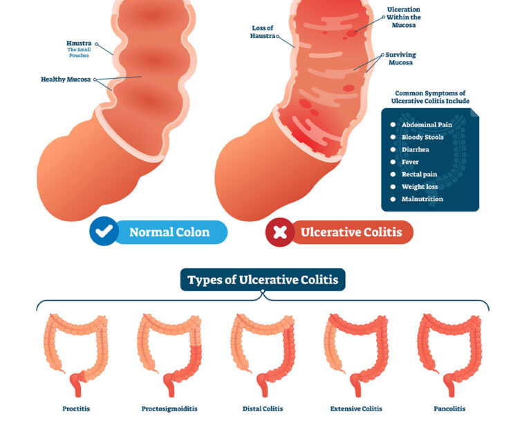 Dr Neeraj Singh - Colon & Rectal Care Center of Phoenix